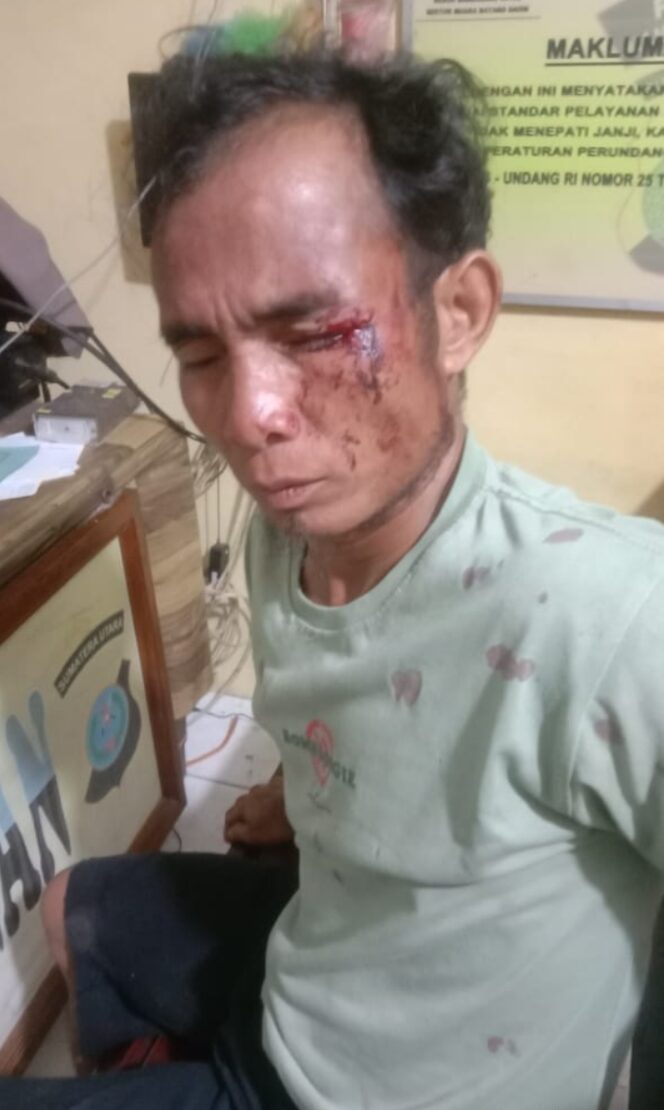 
					Mencari Hati Giawa Tuntut Proses Hukum Terhadap Pelaku Pengeroyokan Secara Bersama sama