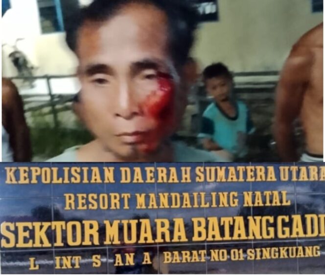 
					Dua Bulan Pasca Dilaporkan Ke Polsek Muara Batang Gadis, Terduga Pelaku Pengeroyokan Masih Bebas Berkeliaran