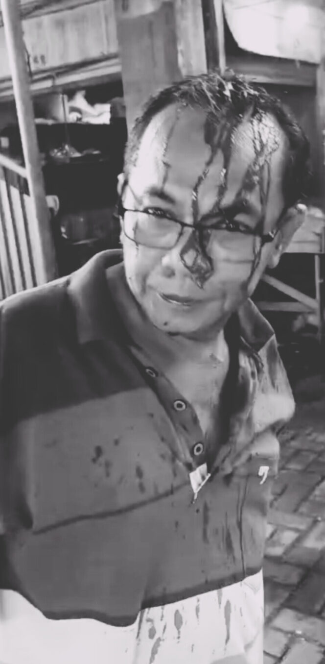 
					Preman Bertindak Brutal Wilayah Tembung, Korban Tuntut Polisi Tegakkan Aturan Hukum Yang Berlaku